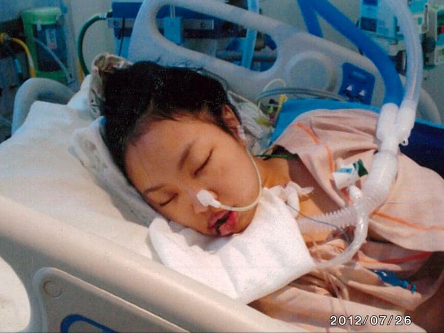 誕生日当日にICUに搬送され、昏睡状態が続いていたときのAさん（写真：Aさん提供）