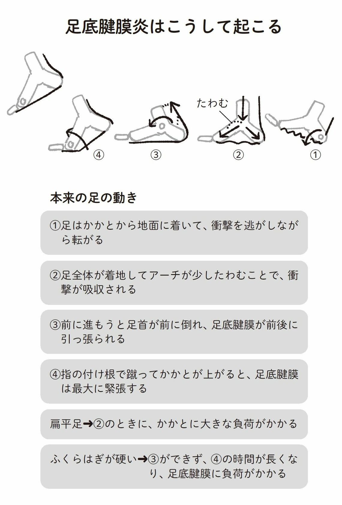 （出所：『外反母趾と足底腱膜炎 自力でできるリセット法』より）