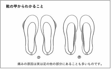 ストア 靴 ふち 痛い