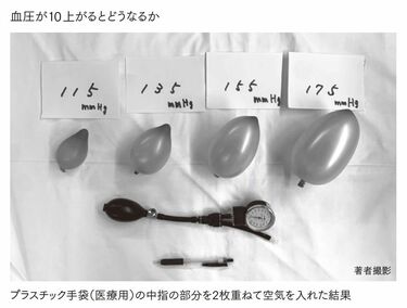 健康診断｢空腹時血糖値が正常｣でも安心できぬ訳 血圧､コレステロール､血糖値の数値の正しい見方 | 健康 | 東洋経済オンライン