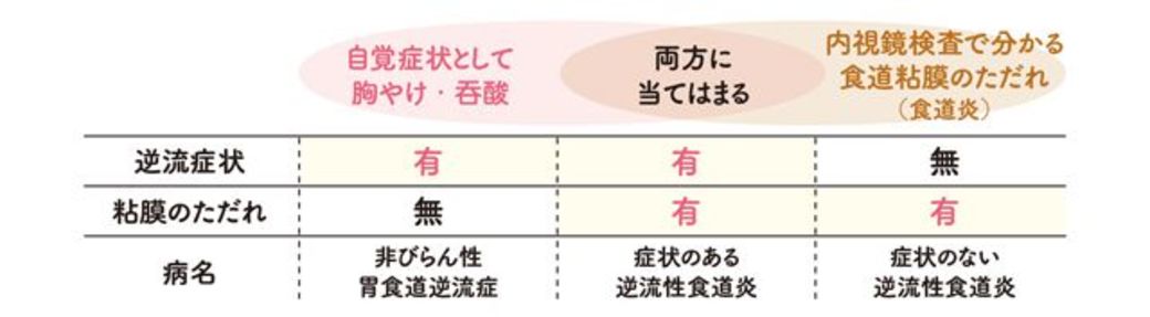 痛み 胸やけ 胃の不調 の放置が危険な理由 毎日が発見ネット 東洋経済オンライン 社会をよくする経済ニュース