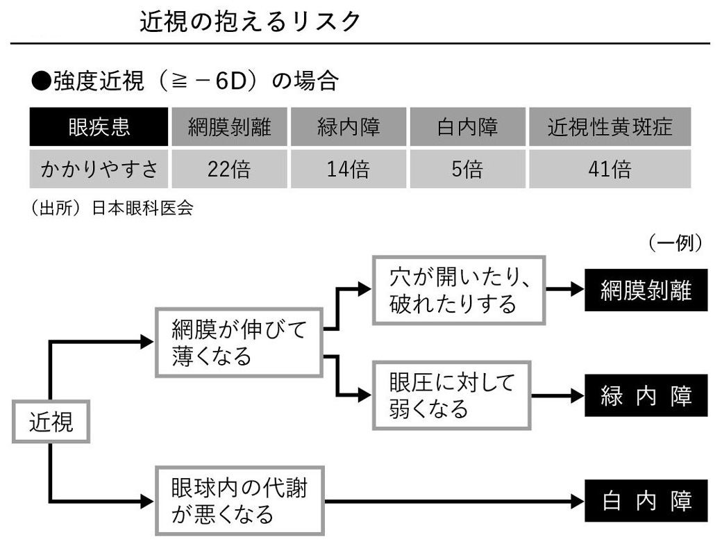 近視は病気です