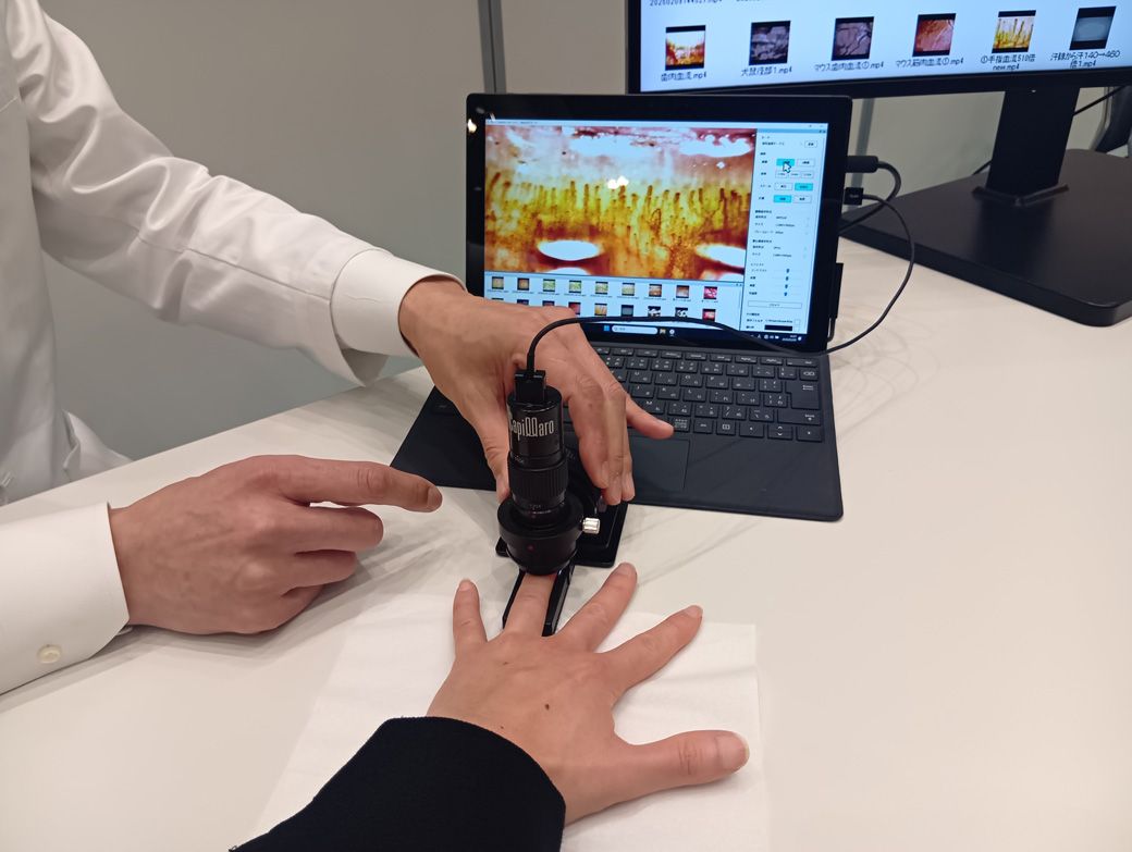 血流測定の様子