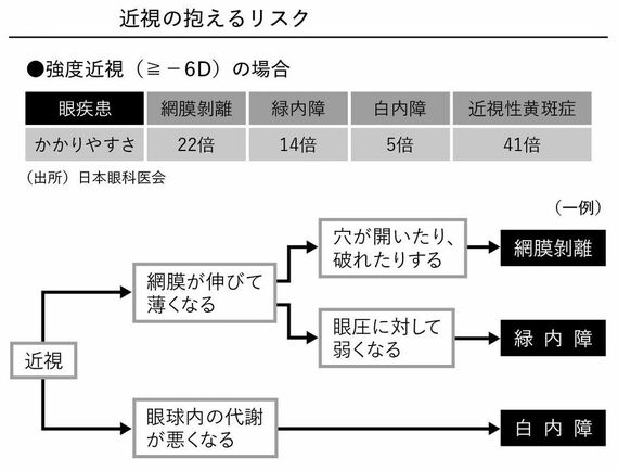 近視は病気です