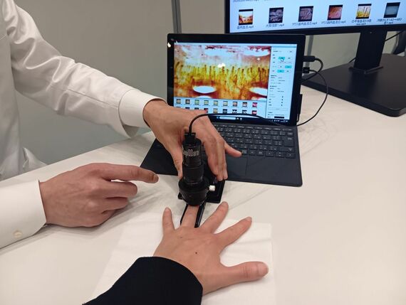 血流測定の様子