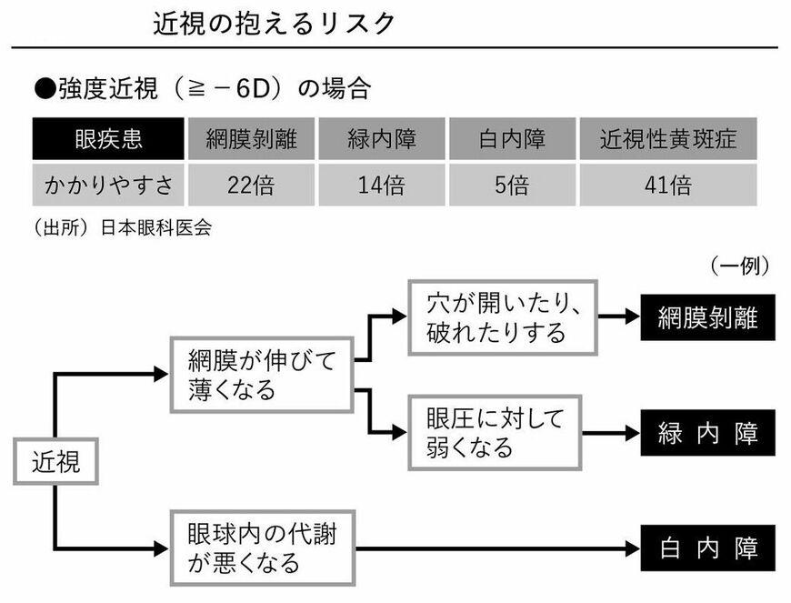 近視は病気です
