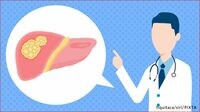 小さければ切除で根治できる 肝臓がん｜脂肪肝由来の患者が増加