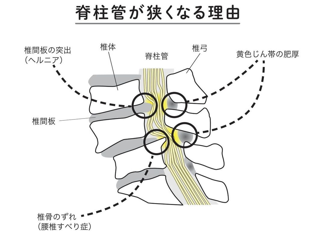 足腰が痛む 新 国民病 簡単にラクにするコツ 健康 東洋経済オンライン 社会をよくする経済ニュース