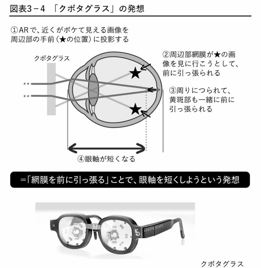 近視は病気です クボタグラス
