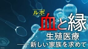【無精子症】オタマジャクシが泳いでいるような精子の画像は映らなかった――宣告された男性の｢煩悶の正体｣