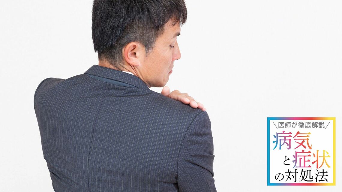 気になるふけの原因と対策法をご紹介します（写真：asu0307／PIXTA）