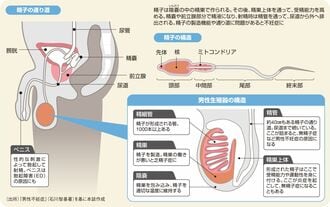 男性不妊をもたらす、４つの原因