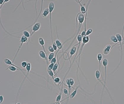 一見良好に見える運動精子でも、精子の中の見えない部分に 空胞（穴）が認められる隠れた異常をもつ精子もたくさんある（写真：黒田インターナショナルメディカルリプロダクション）