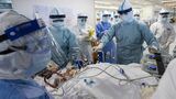 新型コロナウイルスに感染し、重篤な状態にある患者が中国・武漢の病院の集中治療室でECMOにつながれて治療を受けている。写真は2020年4月に撮影（写真：Avalon／時事通信フォト）