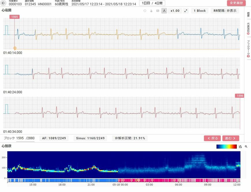 カルディオインテリジェンス社が開発・販売する、長時間心電図解析ソフトウェア『SmartRobin AI シリーズ』
