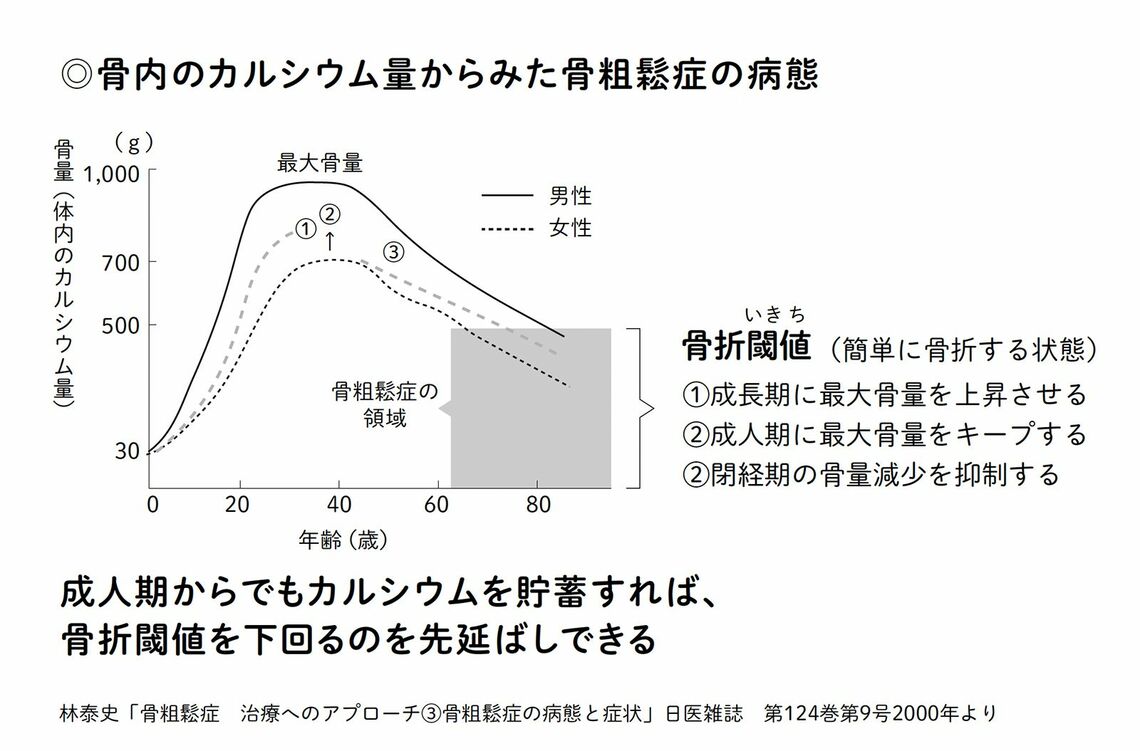 骨粗鬆症の病態