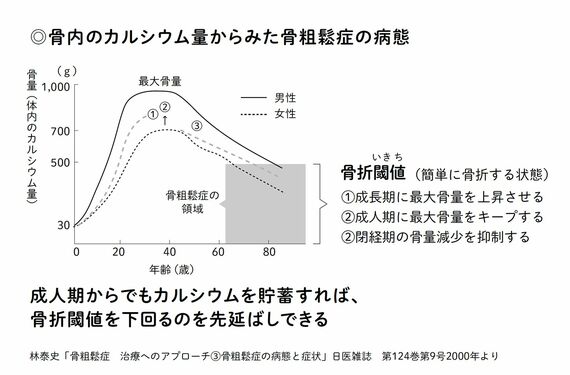 骨粗鬆症の病態