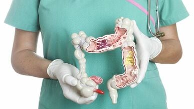 ｢大腸がん｣が日本で増え､アメリカで減る理由 検査が国民に根付いているかどうかがポイント