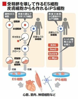 ベンチャーが先導する再生医療、臓器移植の代替も視野に応用研究が進む