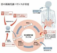クスリの大図鑑 <骨粗鬆症> もはや“生活習慣病”？　女性中心に患者数膨張