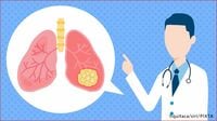 非喫煙者でも油断は禁物 肺がん｜死者数が最も多いがん
