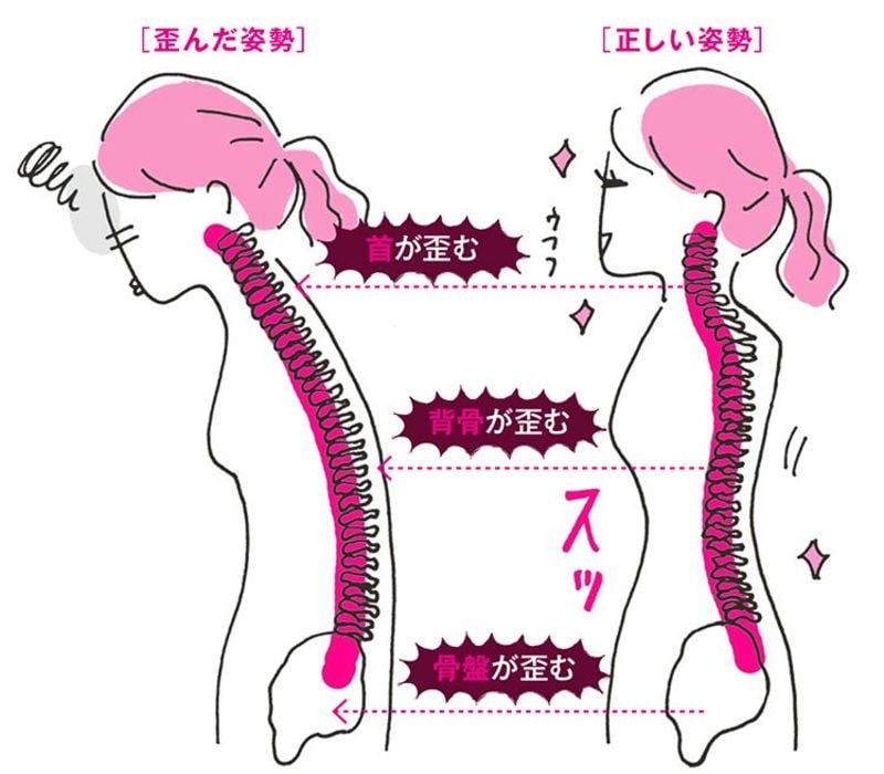 その 鶏首 姿勢が 体調不良の原因になる Voce 東洋経済オンライン 経済ニュースの新基準