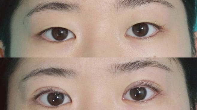 ｢誕プレで美容整形｣小学生の親と医師の"言い分"