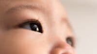 【子どもの斜視】放置すると弱視や複視のおそれ