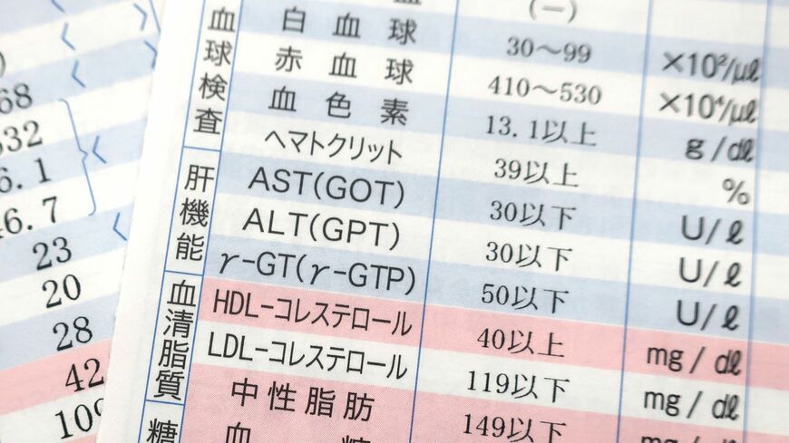 肝臓の健康度を見る肝機能検査。γ‐GTPだけ見ていませんか？（写真：そよかぜ／PIXTA）