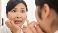 なぜか誤解が多い｢ニキビ｣の知識と対策法 生活のツケは積もり積もって肌に出る