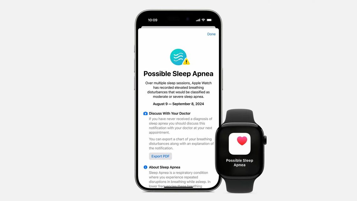 睡眠時無呼吸症候群の通知は日本を含めた150カ国で展開する（写真:アップル）