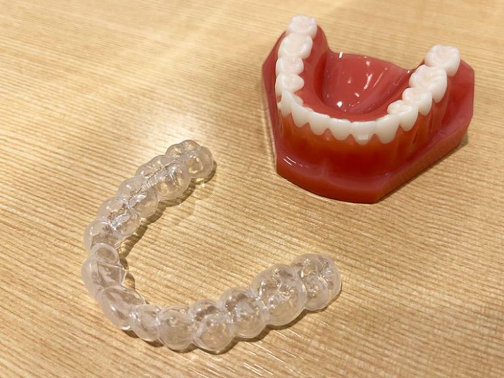 これがそれぞれの歯型に合わせて作った“トレー”です（写真：Domani編集部）