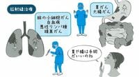 先進国で唯一｢がん死｣が増加する日本の悲劇 早期発見できれば95％治せる病気なのに…