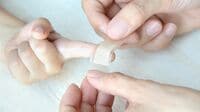 ｢傷ができたらまず消毒｣はNG!?｢傷ケア｣の新常識 ｢鼻血･あかぎれ･虫刺され｣のときの対処法は？
