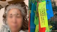 始まりは左目の小さなアザ…原因不明の難病｢サルコイドーシス｣で日常を奪われた女性（62）が悔やむ"病院を避けた過去"