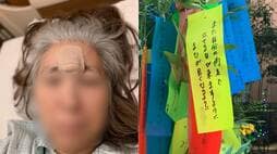始まりは左目の小さなアザ…原因不明の難病｢サルコイドーシス｣で日常を奪われた女性（62）が悔やむ"病院を避けた過去"
