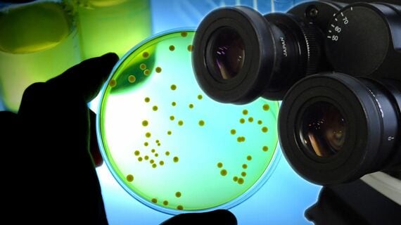 シャーレのなかの微生物と顕微鏡