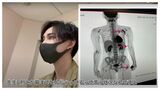 片腕切断