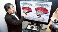 期待のバイオベンチャー 治療に革命を起こせるか