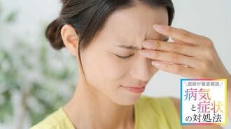 【頭痛】首こりが原因？緊張型頭痛の劇的改善法