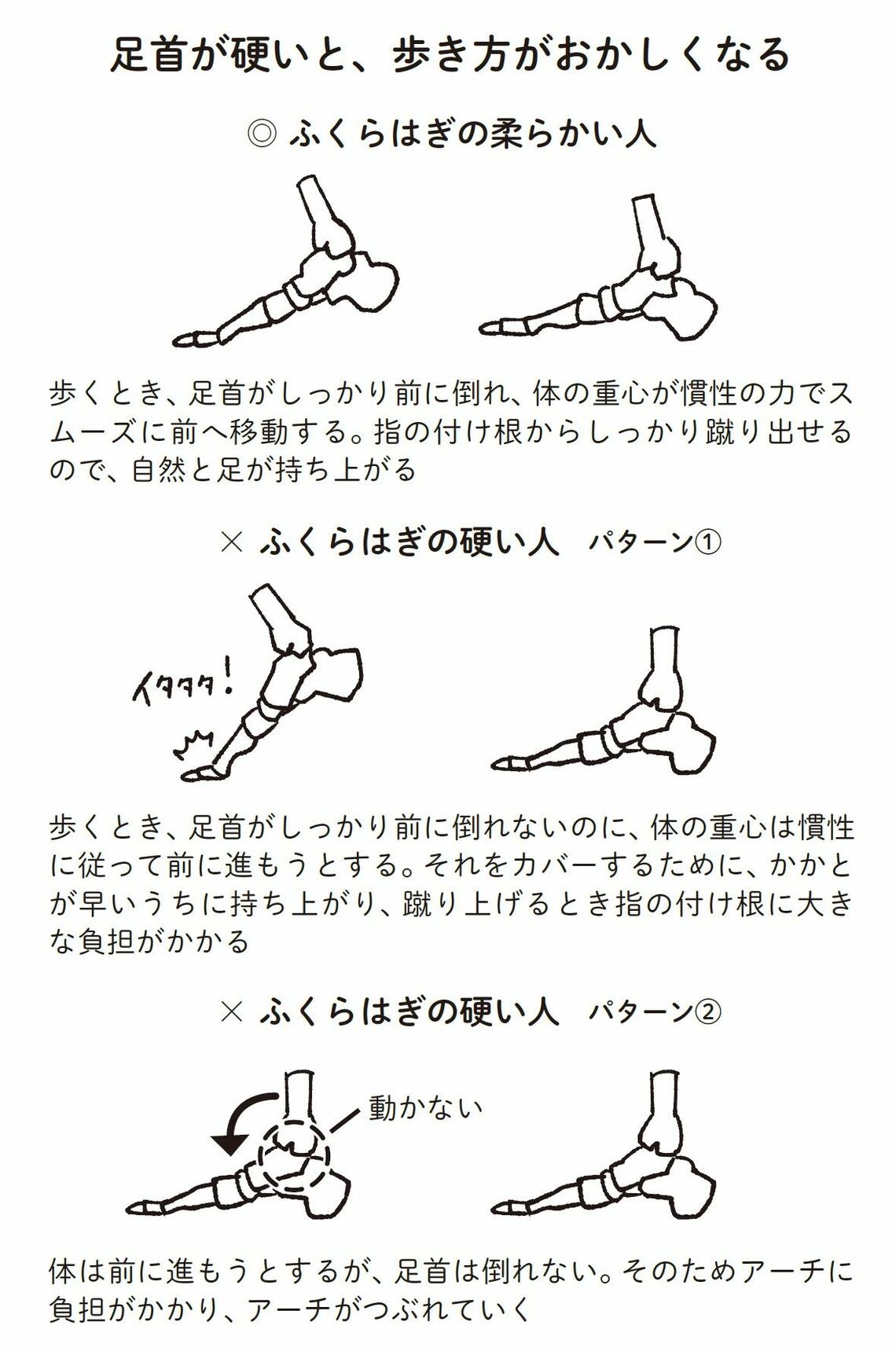 （出所：『外反母趾と足底腱膜炎 自力でできるリセット法』より）