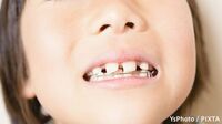 成長期での早期治療を 子どもの歯と目に注意