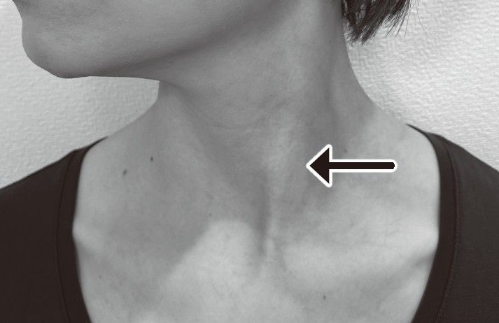 （出所：『首の痛み・コリ・しびれ 自力でできるリセット法』より）