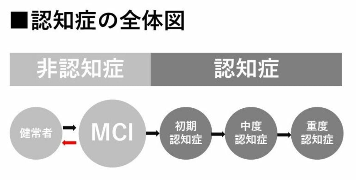 認知症｢一歩手前｣の特徴と予防のためにできる事 そのもの忘れは｢病的な健忘｣か｢加齢現象｣か ｢病気｣と｢症状｣の対処法 東洋経済オンライン