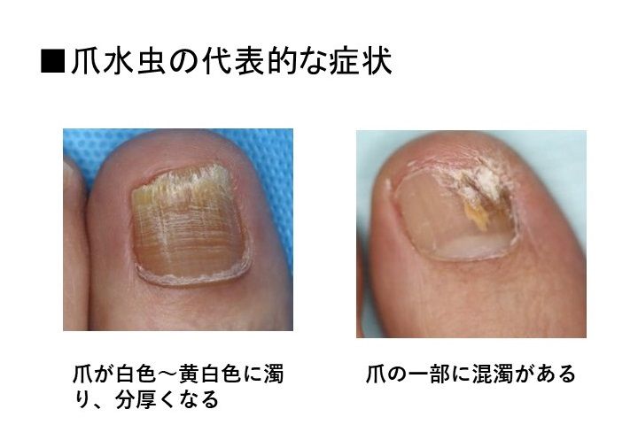 福田医師への取材を基に東洋経済作成