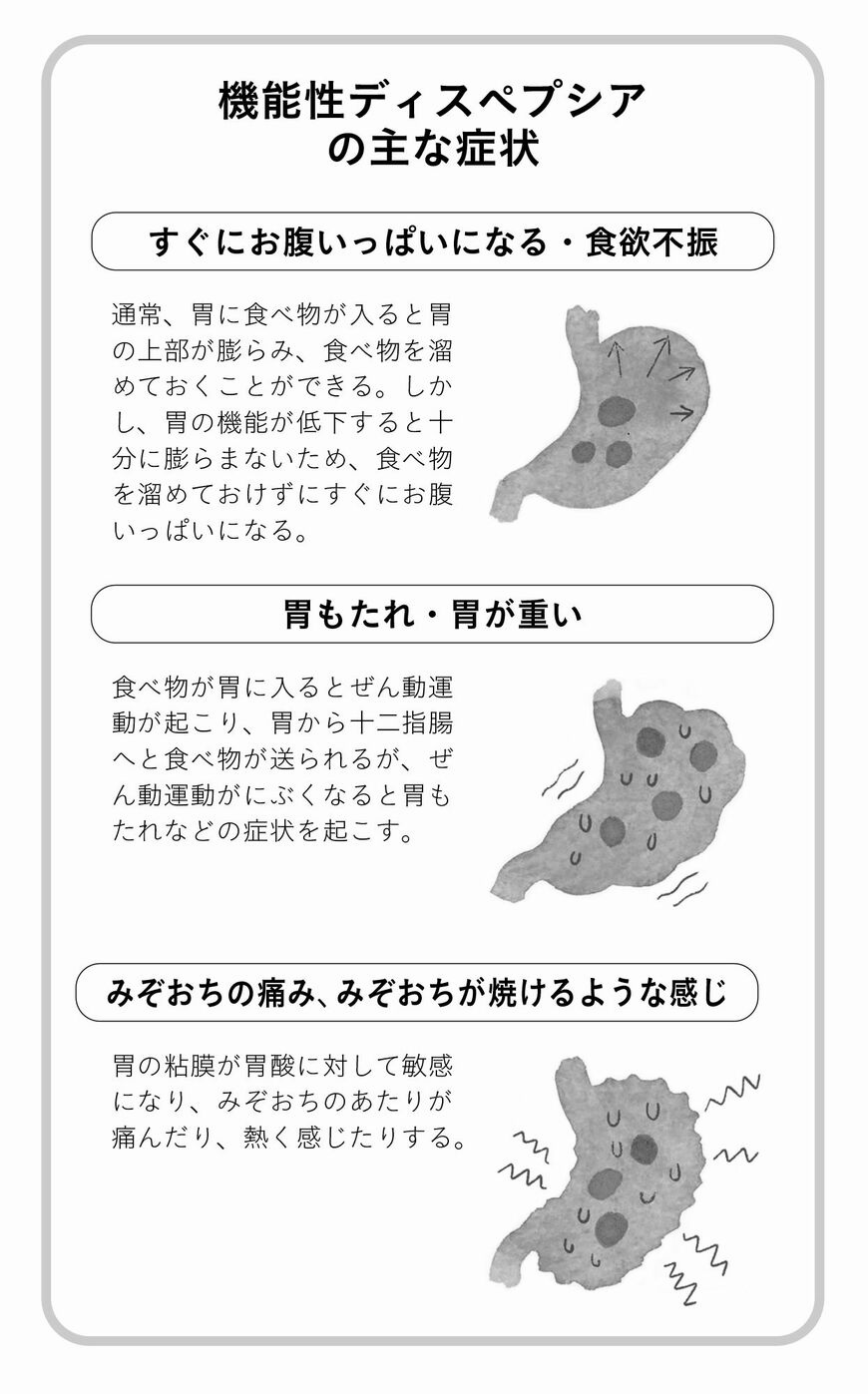 機能性ディスペプシア