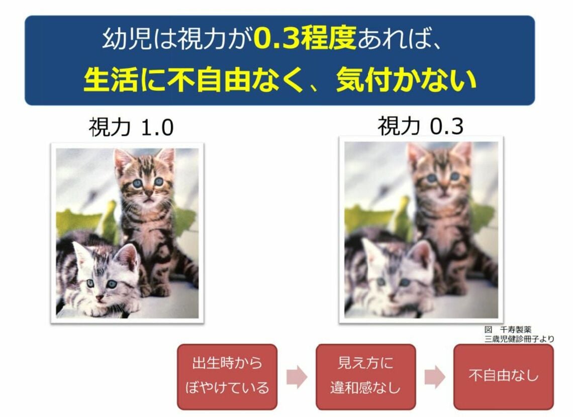 ｢子どもの弱視見逃し｣は脳の発達に影響の深刻 3歳児健診での早期発見･治療が必要な理由 子育て 東洋経済オンライン