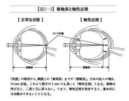 『スマホ失明』P.65より