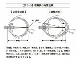 『スマホ失明』P.65より