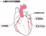 「冠動脈」とは心臓を取り巻く血管のことで、ここから心臓に栄養や酸素が供給される。冠動脈が「動脈硬化」を起こしてしまうと、心臓に十分な血液が流れず、最悪の場合は「心筋梗塞」などを引き起こしてしまう（イラスト『「100年心臓」のつくり方』より）